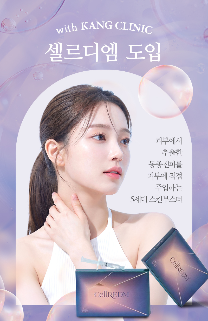 셀르디엠 도입